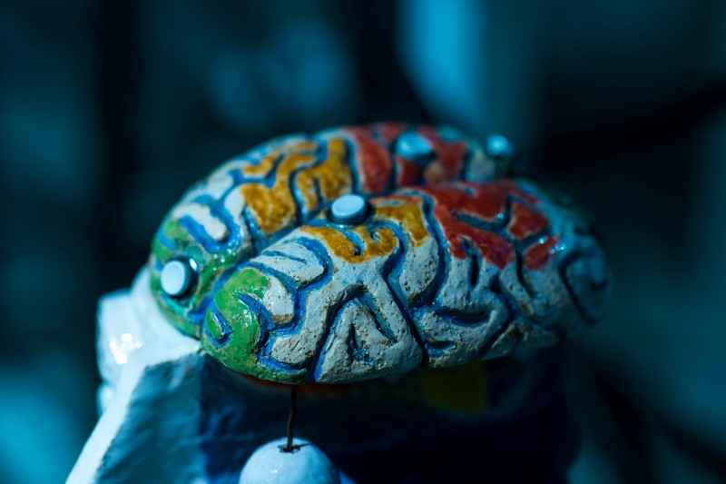 Understanding Brain Hemorrhage: Causes, Symptoms, and Risk Factors