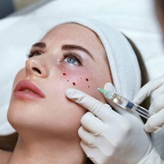 Dermal Fillers
