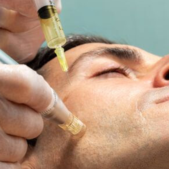 Platelet-rich plasma